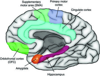 Behavioral And Neuropsychological Aspects Of Frontal And Temporal Lobe Epilepsy Chapter 10 The Neuropsychiatry Of Epilepsy Behavioral And Neuropsychological Aspects Of Frontal And Temporal Lobe Epilepsy Chapter 10 The Neuropsychiatry Of Epilepsy