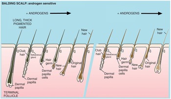 Androgens and hair: a biological paradox with clinical consequences  (Chapter 7) - Testosterone