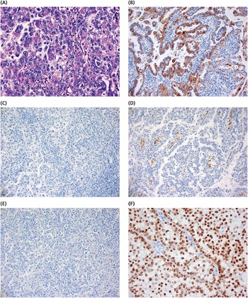 Tumors of the breast and female genital organs (Chapter 8