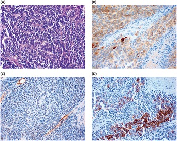 Tumors of the breast and female genital organs (Chapter 8