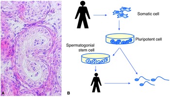 spermatogonia spermatositler spermatidler spermatozoa