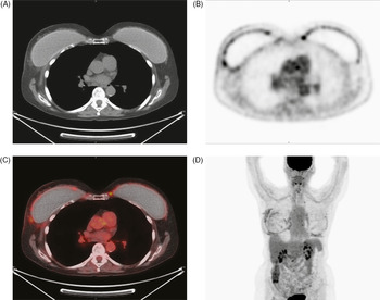 Medical Devices: Other Considerations (Section IV) - Radiologic