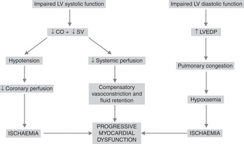 Cardiogenic Shock Chapter 19 Questions For The Final Fficm Structured Oral Examination