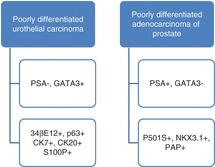 prostate vs urothelial carcinoma immunohistochemistry