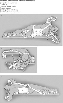 Surgical Positioning Chapter 14 Gupta And Gelb S Essentials Of