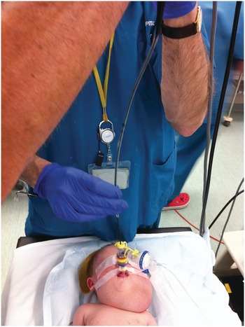 Devices and Techniques to Manage the Abnormal Airway (Section 2