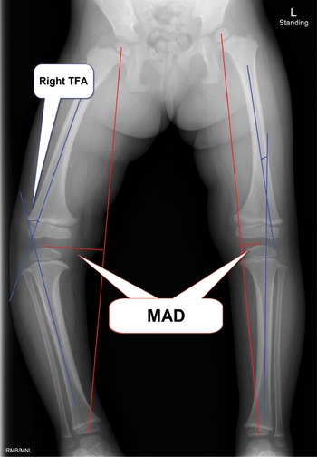 Children's Orthopaedics/Hand and Upper Limb (Section 4