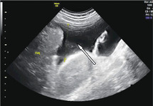 Baseline Sonographic Assessment Of The Female Pelvis Chapter 2 Gynaecological Ultrasound Scanning