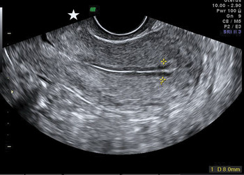 Get To Know Your Machine And Scanning Environment Chapter 1 Gynaecological Ultrasound Scanning