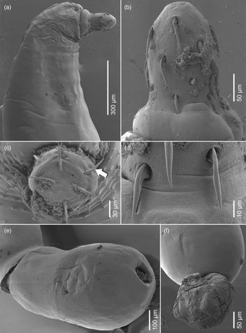 Redescription Of Acanthogyrus Acanthosentis Maroccanus Dollfus 1951 Acanthocephala Quadrigyridae A Parasite Of The Algerian Barb Luciobarbus Callensis Valenciennes Cyprinidae In Algeria And First Molecular Data Journal Of Helminthology