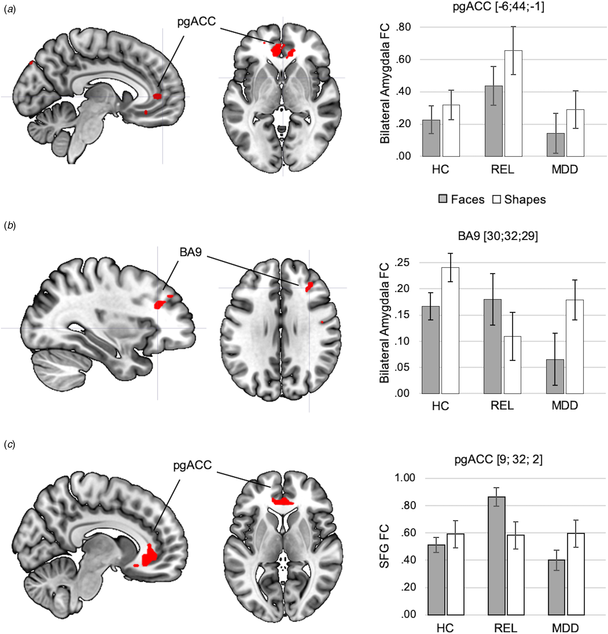 Amygdala Functional Connectivity In Major Depression Disentangling