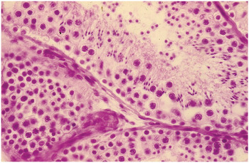 Normal Histology And Histopathology Of The Testicle And Pathology