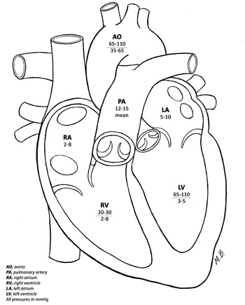 A Congenital Heart Disease Primer Chapter 1 Congenital Cardiac Anesthesia