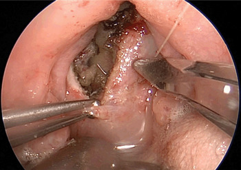 Nostril to Caudal: Cutting and Cooking Fish Tongues