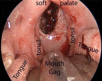 Nostril to Caudal: Cutting and Cooking Fish Tongues