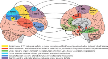 A framework for understanding the pathophysiology of functional ...
