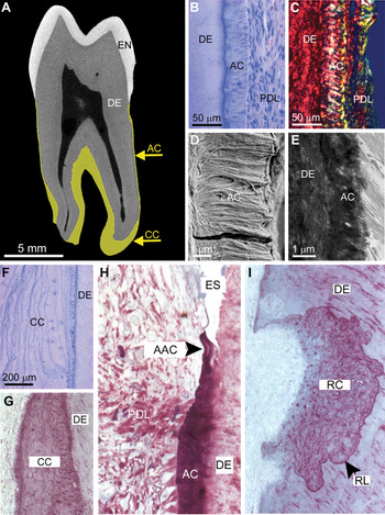 Cemento Provy - Odontologia Peru