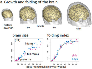 Mapping the Human Brain from the Prenatal Period to Infancy Using 3D  Magnetic Resonance Imaging (Chapter 3) - The Cambridge Handbook of  Cognitive Development