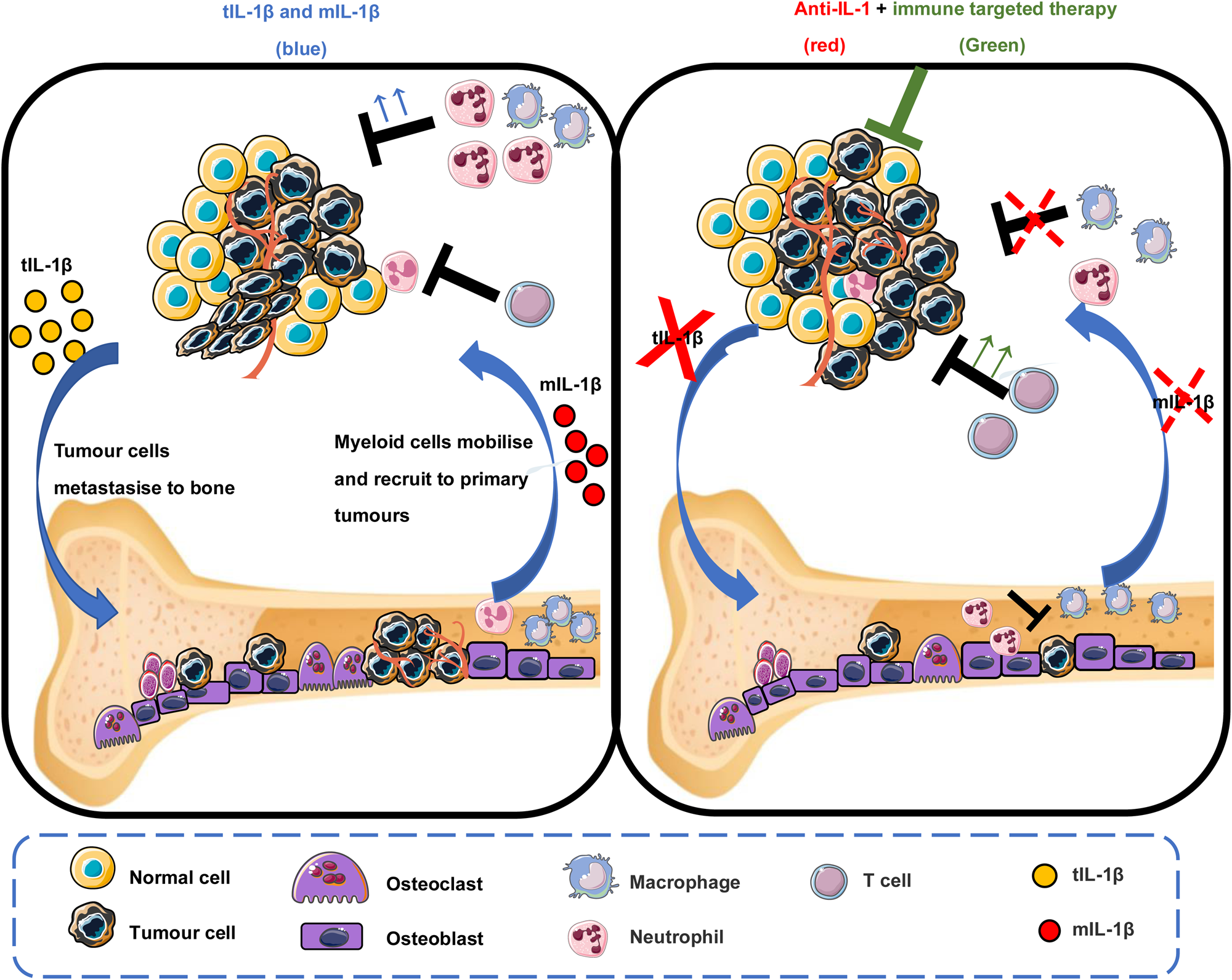 IL-1β In Breast Cancer Bone Metastasis | Expert Reviews In Molecular ...