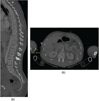 Adult Elective Orthopaedics and Spine (Section 2)