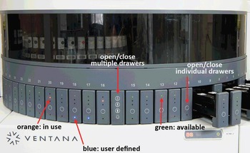 Automation and Robotics with the Roche Ventana BenchMark ULTRA (Chapter 4)  - Immunohistochemistry