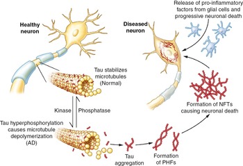 Alzheimer's (Chapter 8) - Managing Discovery in the Life Sciences