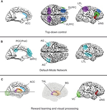 Visual word processing engages a hierarchical, distributed, and bilateral  cortical network - ScienceDirect