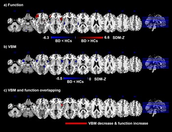 Functional and structural brain differences in bipolar disorder: a ...