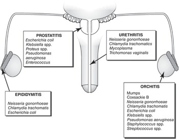 Infection In ammation and Immunological Causes of Male