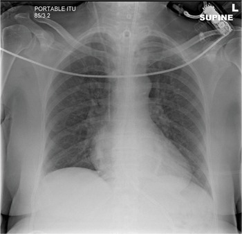 Imaging of the Chest (2.8) - Intensive Care Medicine