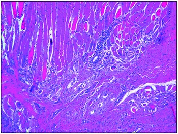 Modern Soft Tissue Pathology