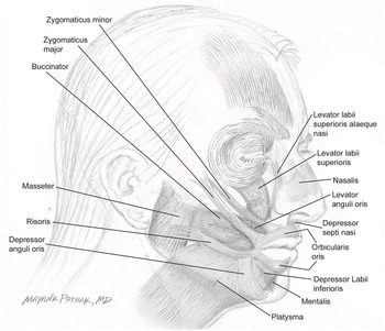 Botulinum Toxin for the Lower Face Chapter 23 Manual of