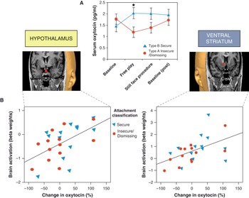 PDF] The plasticity of human maternal brain: longitudinal changes in brain  anatomy during the early postpartum period.