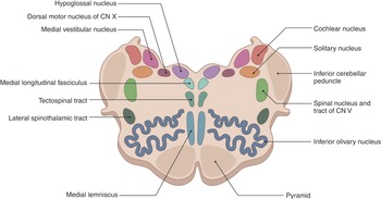Figure 30