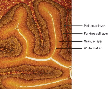 Figure 33
