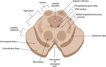 Figure 27