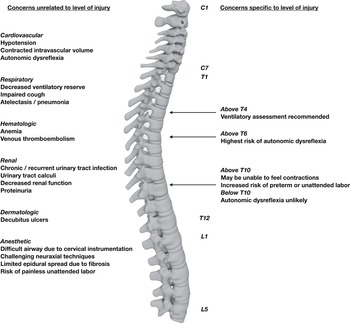 Spinal Cord Disorders Chapter 15 Obstetric Anesthesia and