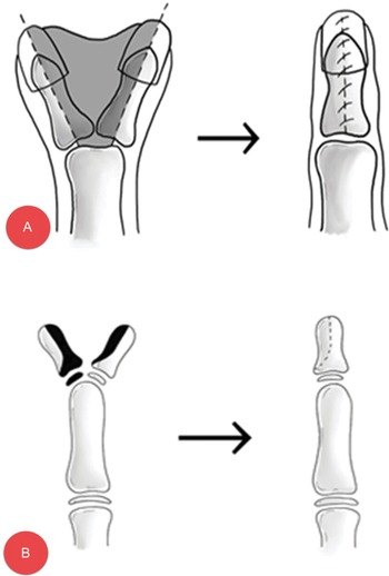 Orthopaedic Hand and Wrist Disorders (Chapter 16) - Postgraduate