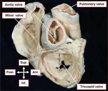 Wilcox's Surgical Anatomy of the Heart: 9781009387392