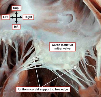 Wilcox's Surgical Anatomy of the Heart: 9781107014480