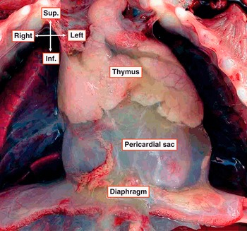 Surgical Approaches to the Heart (Chapter 1) - Wilcox's Surgical