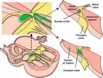 Surgical Anatomy of Cardiac Conduction (Chapter 6