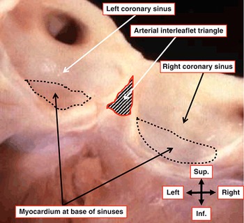 Wilcox's Surgical Anatomy of Heart第4版 Wilcox's Surgical Anatomy of the Heart: 9781009387392: Medicine