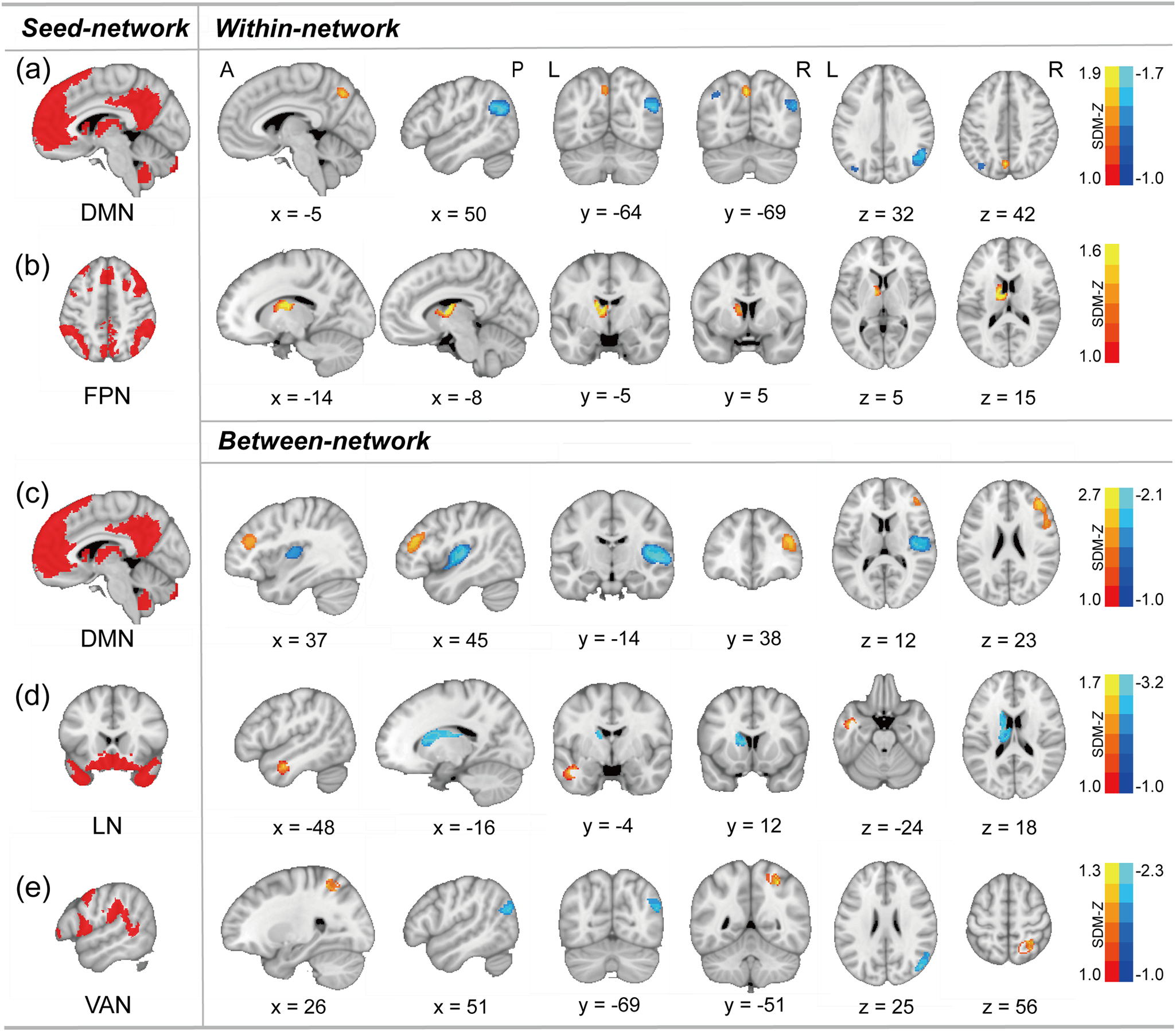 Resting-state network alterations in depression: a comprehensive meta ...