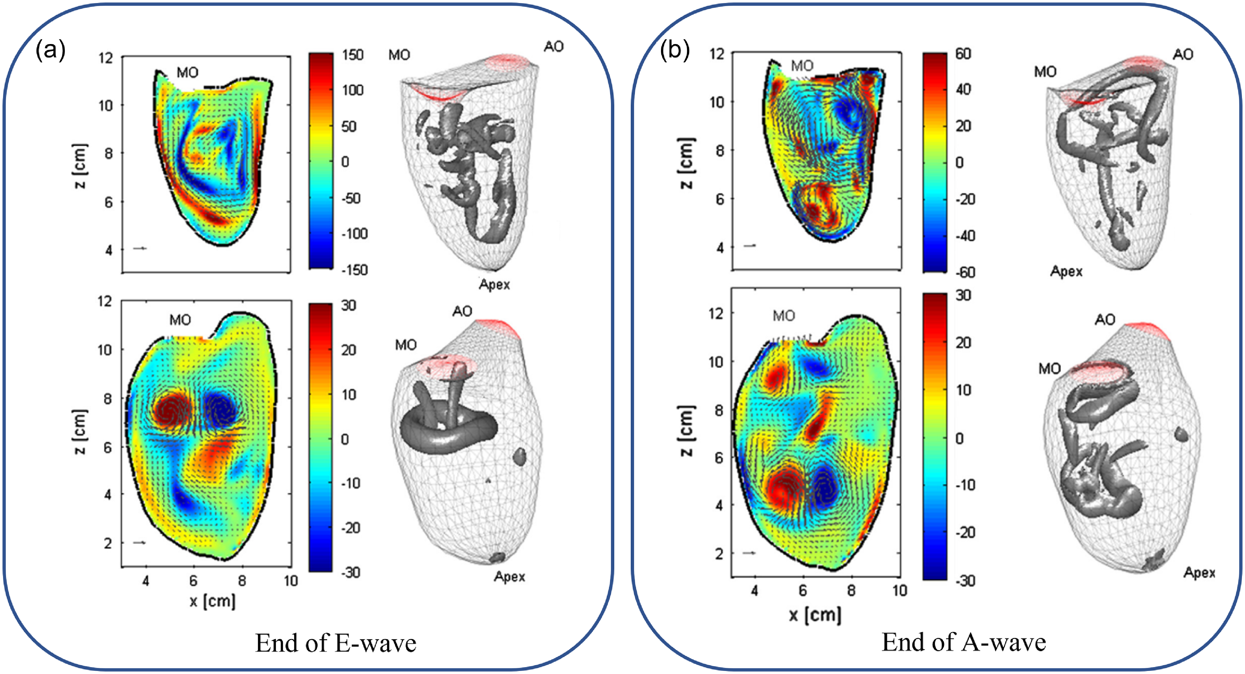 A review on vortex dynamics in the healthy and dilated left ventricles ...