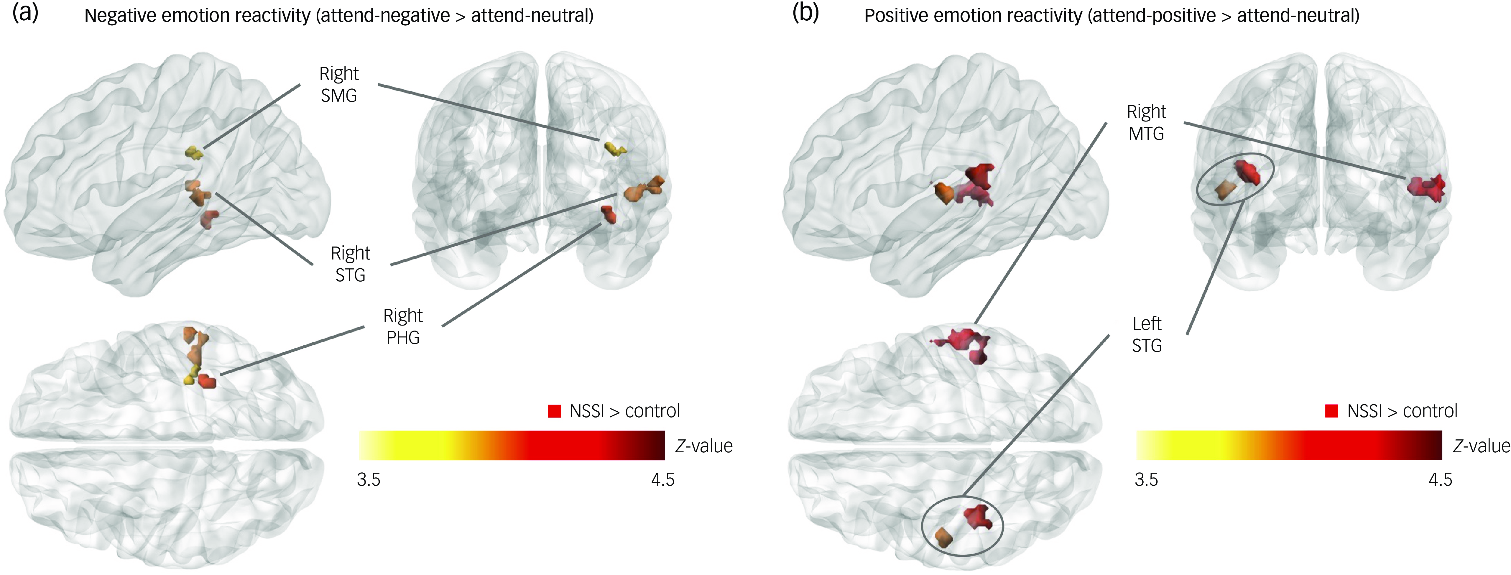 Differential neural activity associated with emotion reactivity and ...