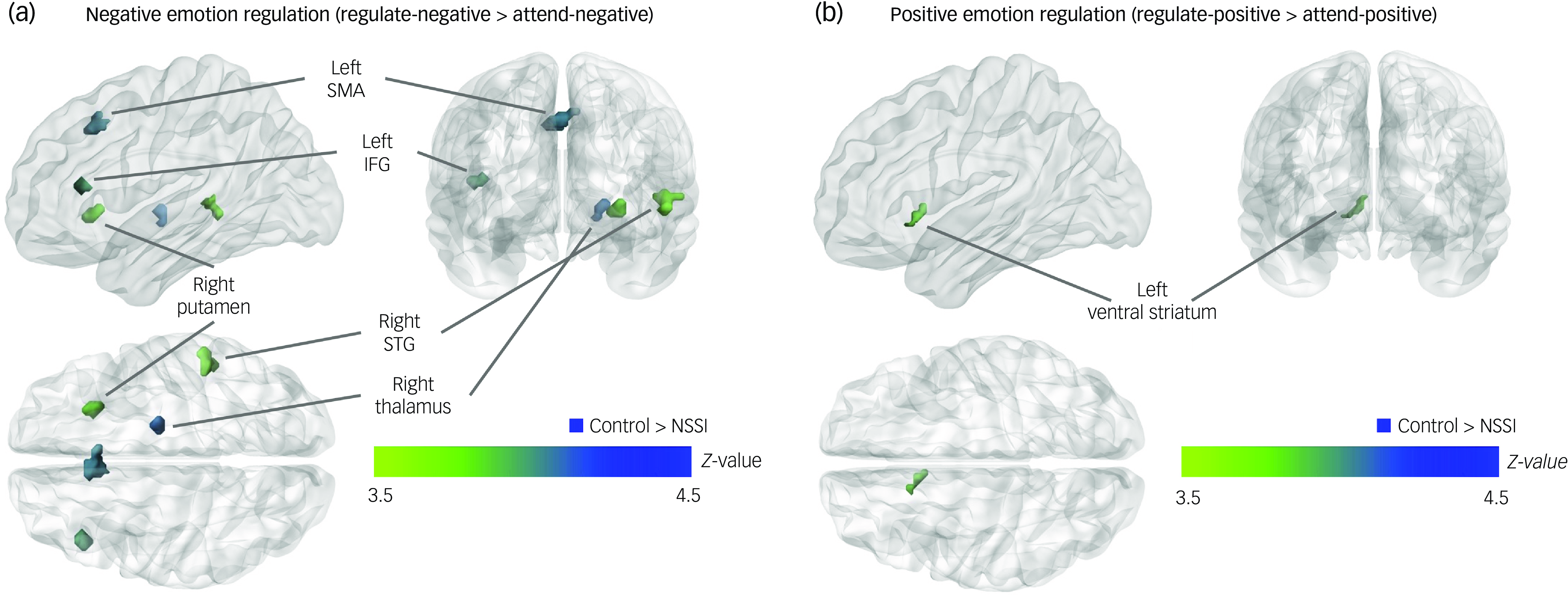 Differential neural activity associated with emotion reactivity and ...