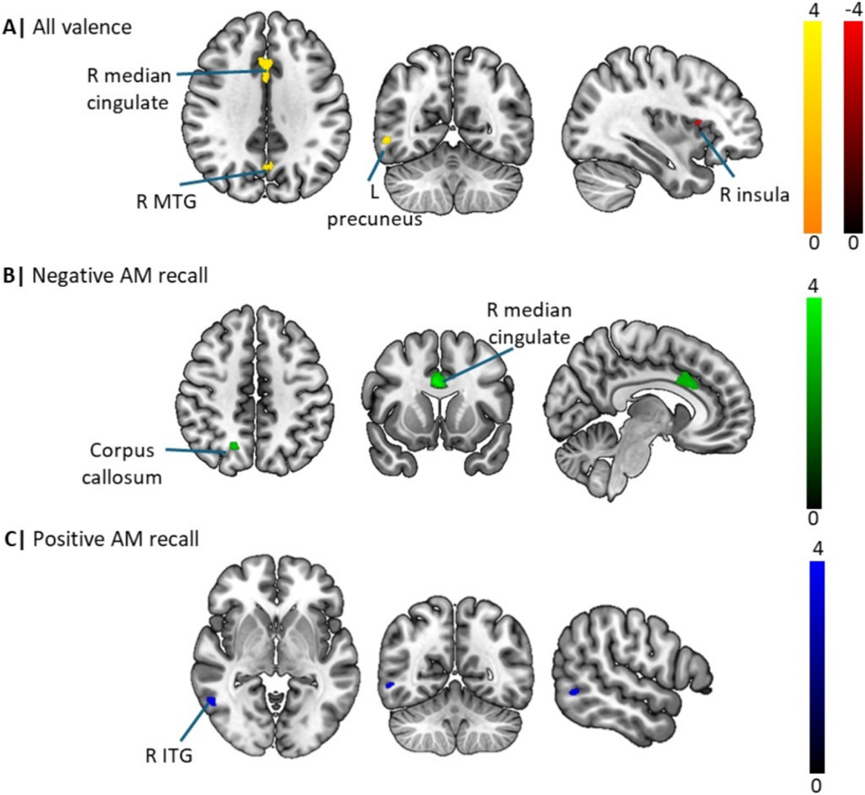 Neural systems underlying autobiographical memory dysregulations in ...