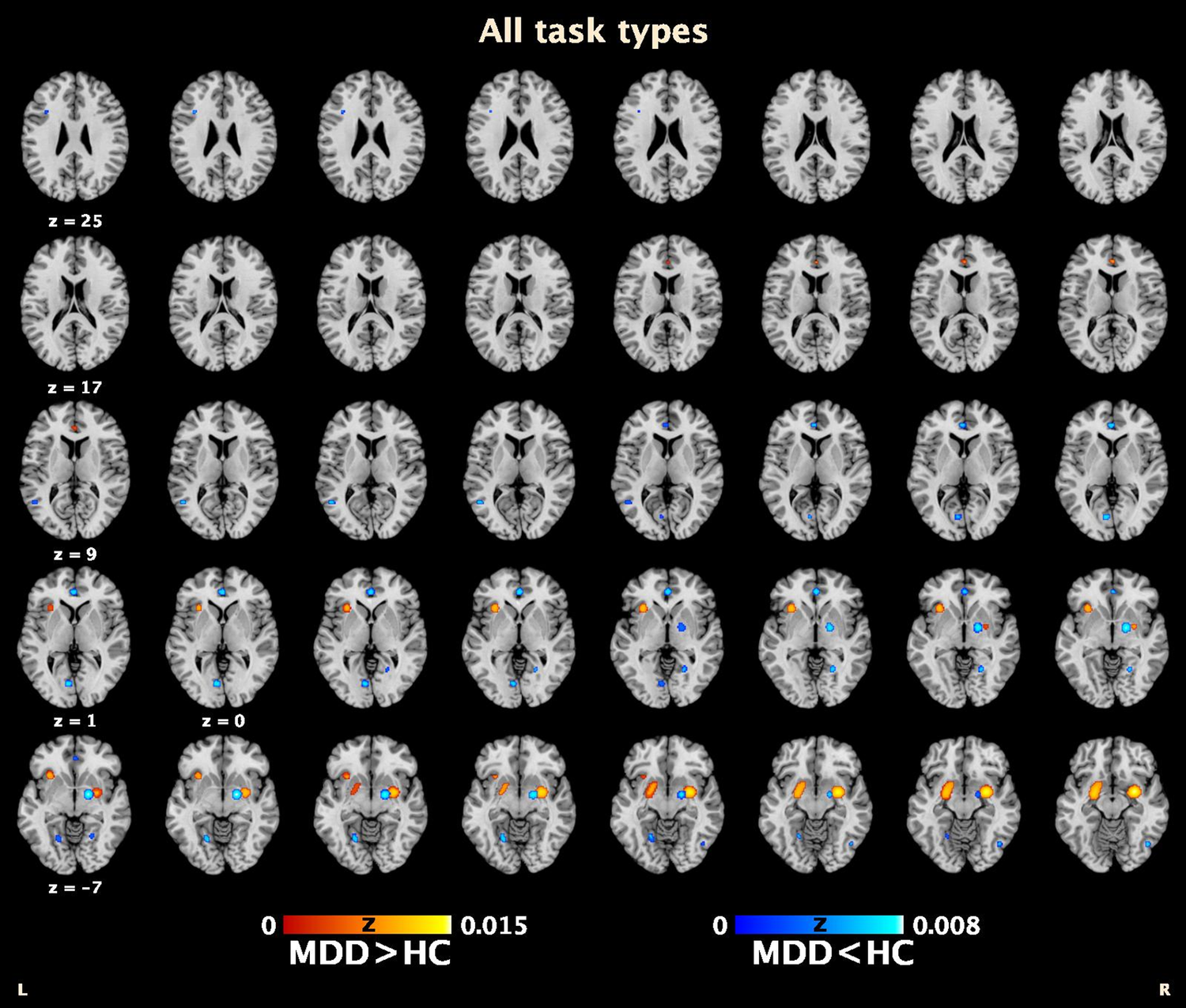 Meta-analysis of neural correlates of working memory, reward, and ...