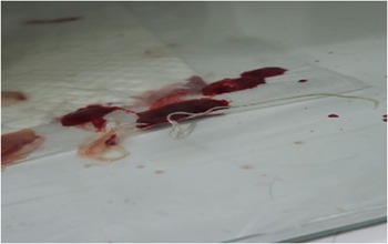 Figure 0